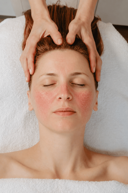 Rosacea behandelen met natuurlijke huidverzorging